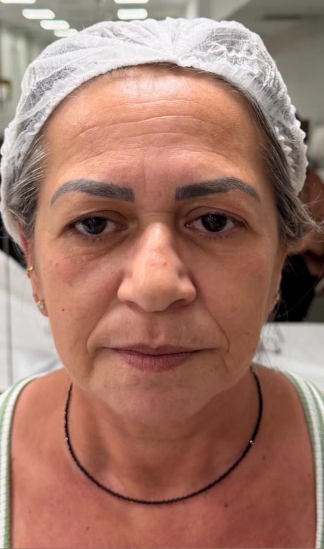 Before: Case 01, Face