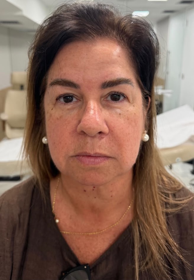 Before: Case 02, Face