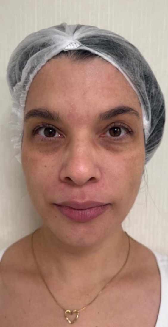 Before: Case 03, Face