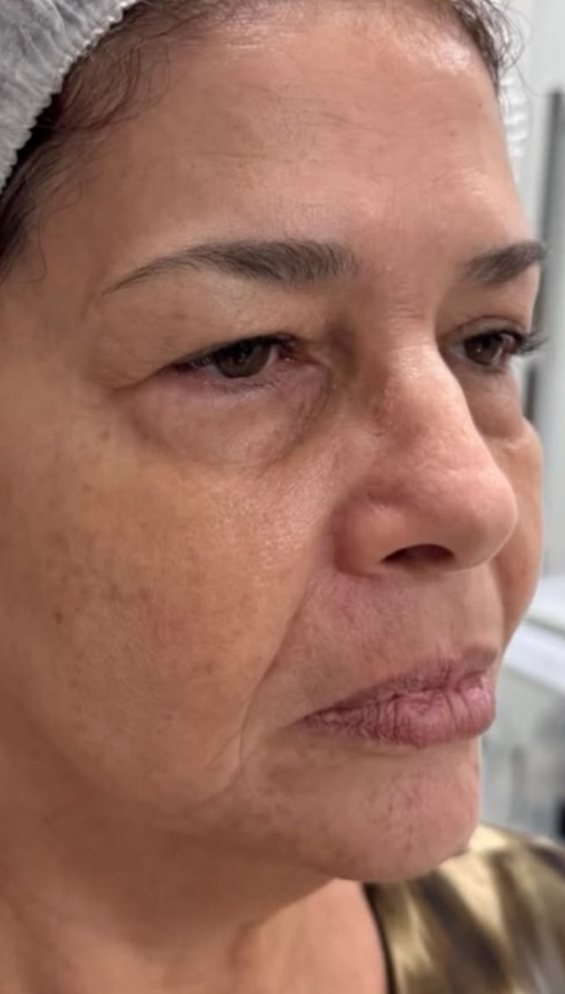 Before: Case 04, Face