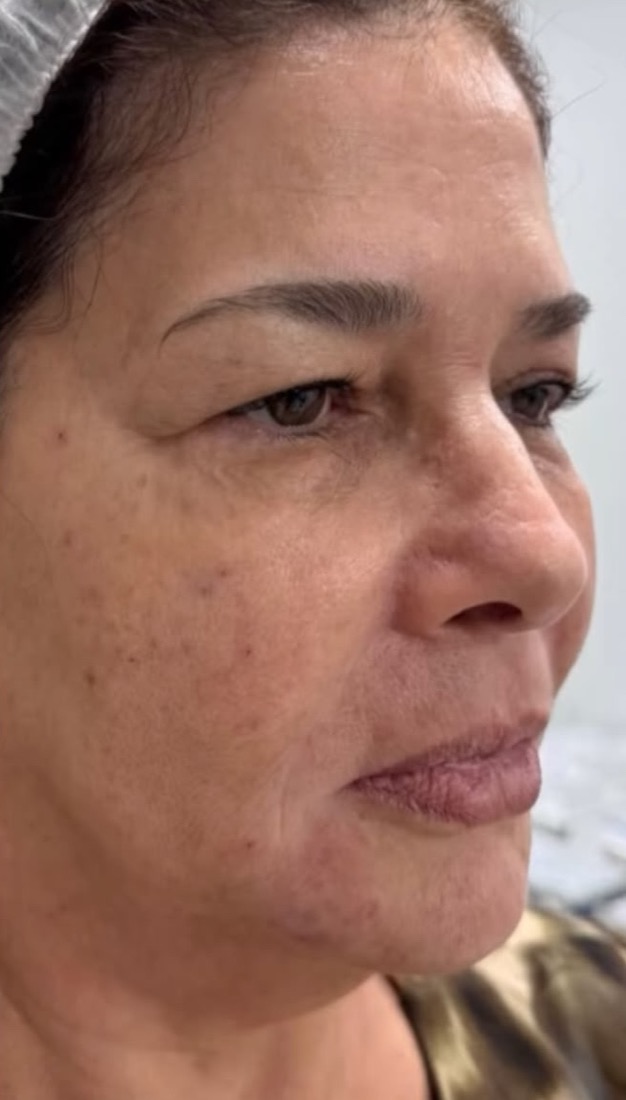 After: Case 04, Face