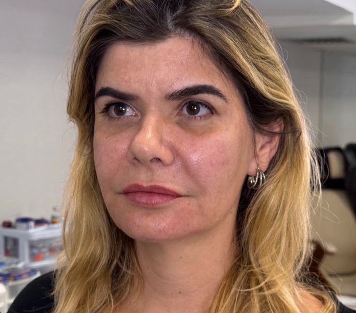 After: Case 05, Face